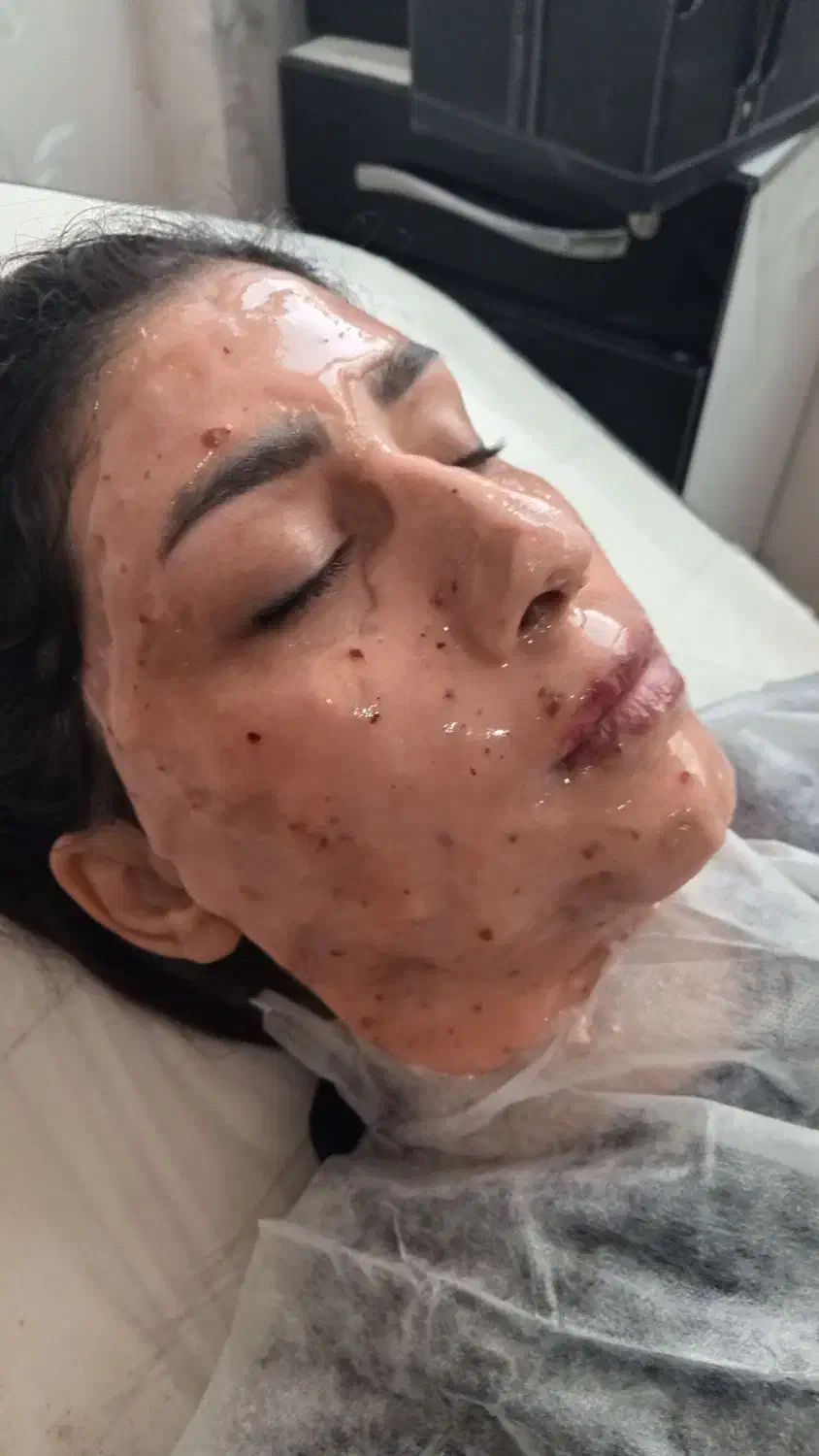 درماپلنیگ پاک سازی صورت|خدمات آرایشگری و زیبایی|بیرجند, |دیوار