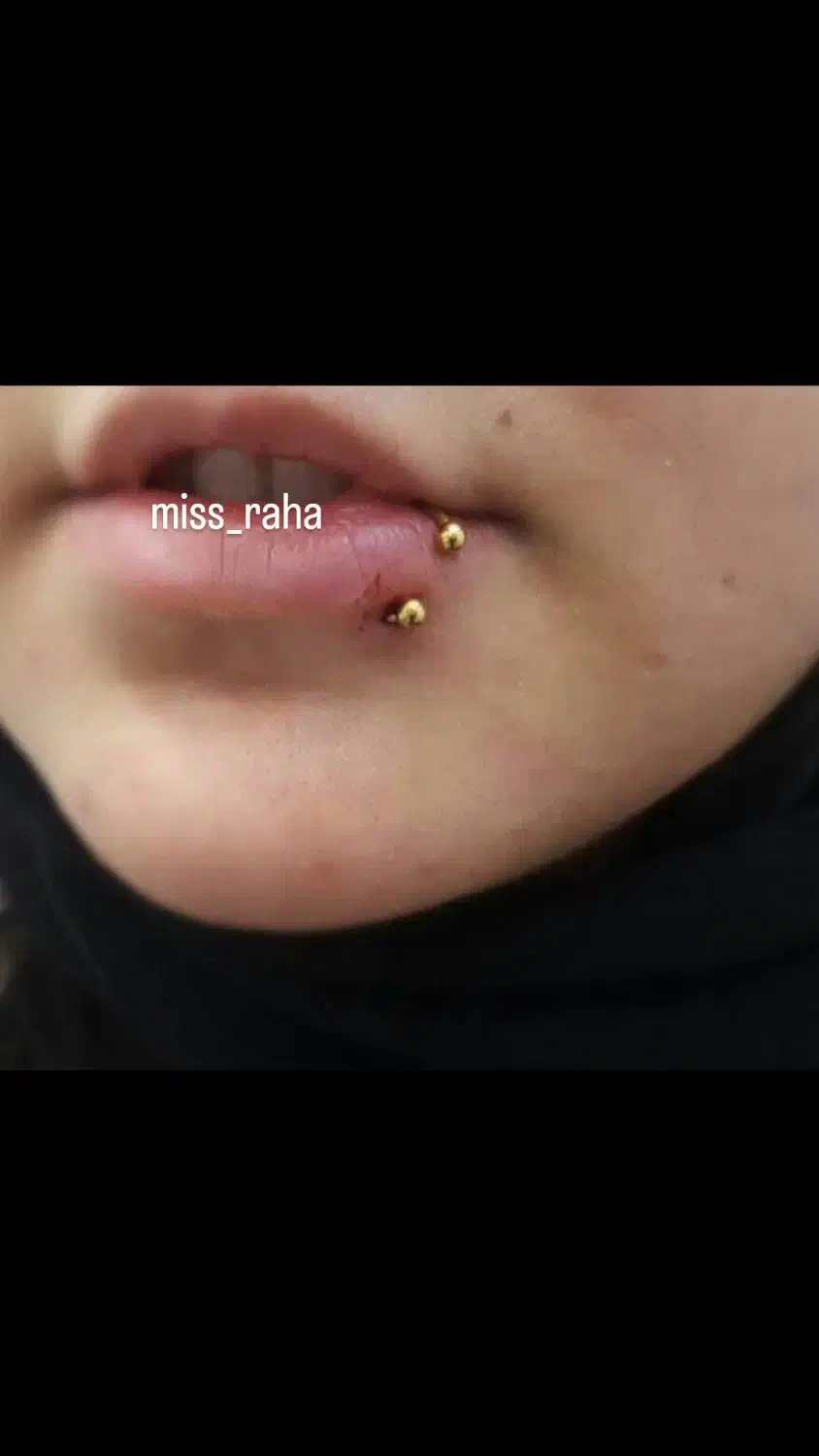 ژل، بوتاکس، پرسینگ، چالگونه|خدمات آرایشگری و زیبایی|اهواز, کمپلو جنوبی|دیوار