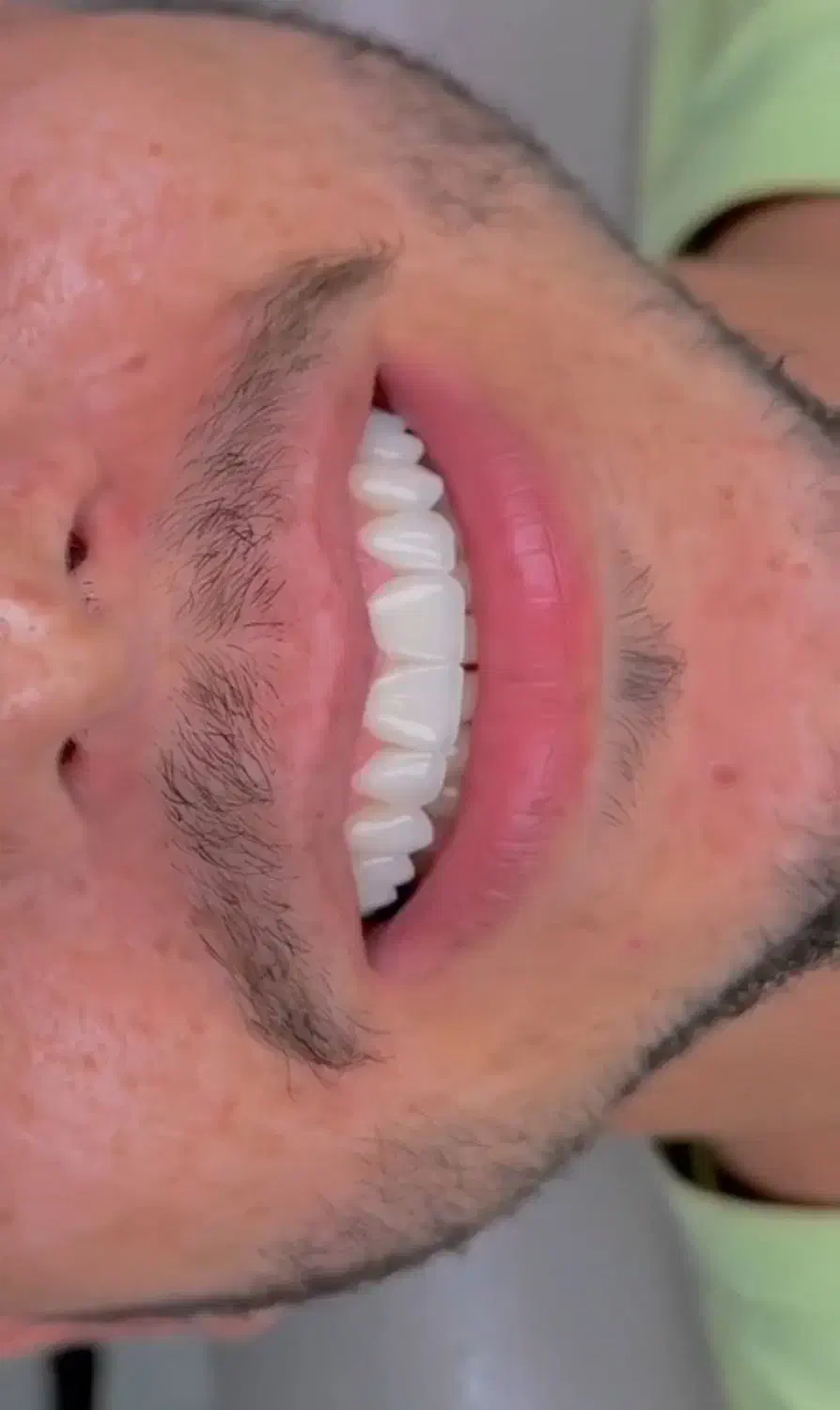 دندانپزشکی|خدمات آرایشگری و زیبایی|کوهدشت, |دیوار