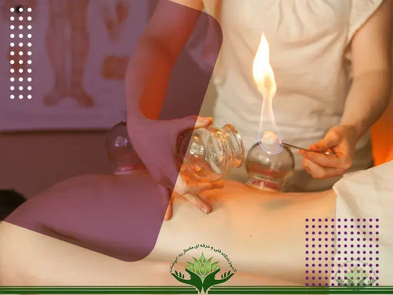 حجامت. بادکش درمانی. زالو درمانی|خدمات آرایشگری و زیبایی|یاسوج, |دیوار