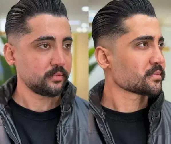 ژل و بوتاکس کاشت ابرو قسطی|خدمات آرایشگری و زیبایی|یاسوج, |دیوار