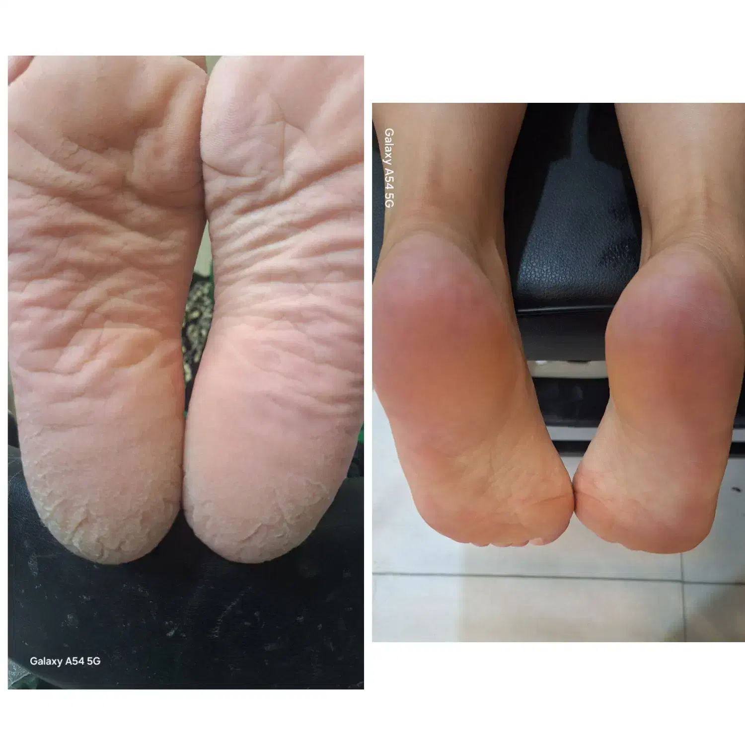 پدیکور. پا|خدمات آرایشگری و زیبایی|یاسوج, |دیوار