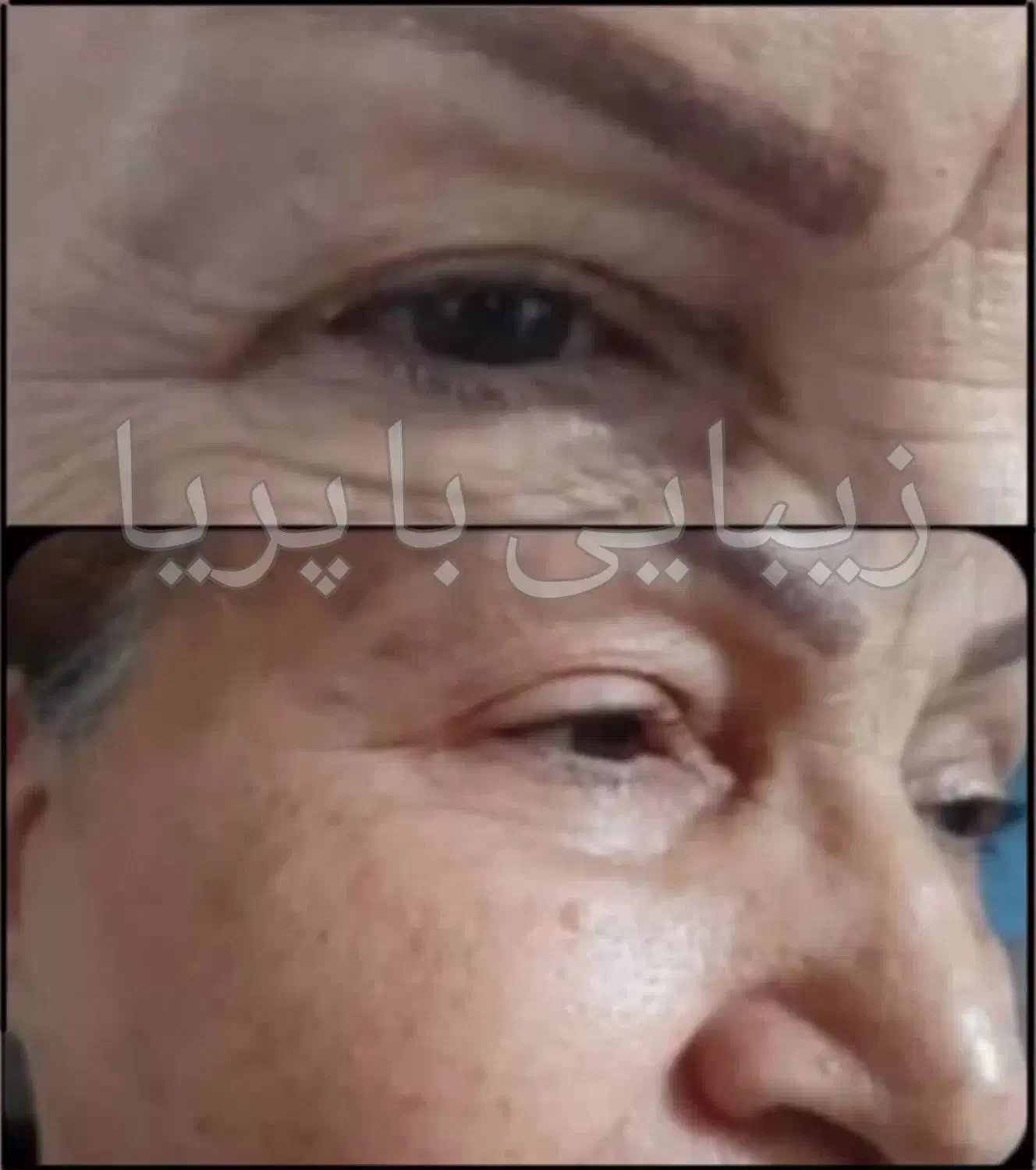 پوستت رو ۲۰ سال جوونتر کن|آرایشی، بهداشتی، درمانی|املش, |دیوار