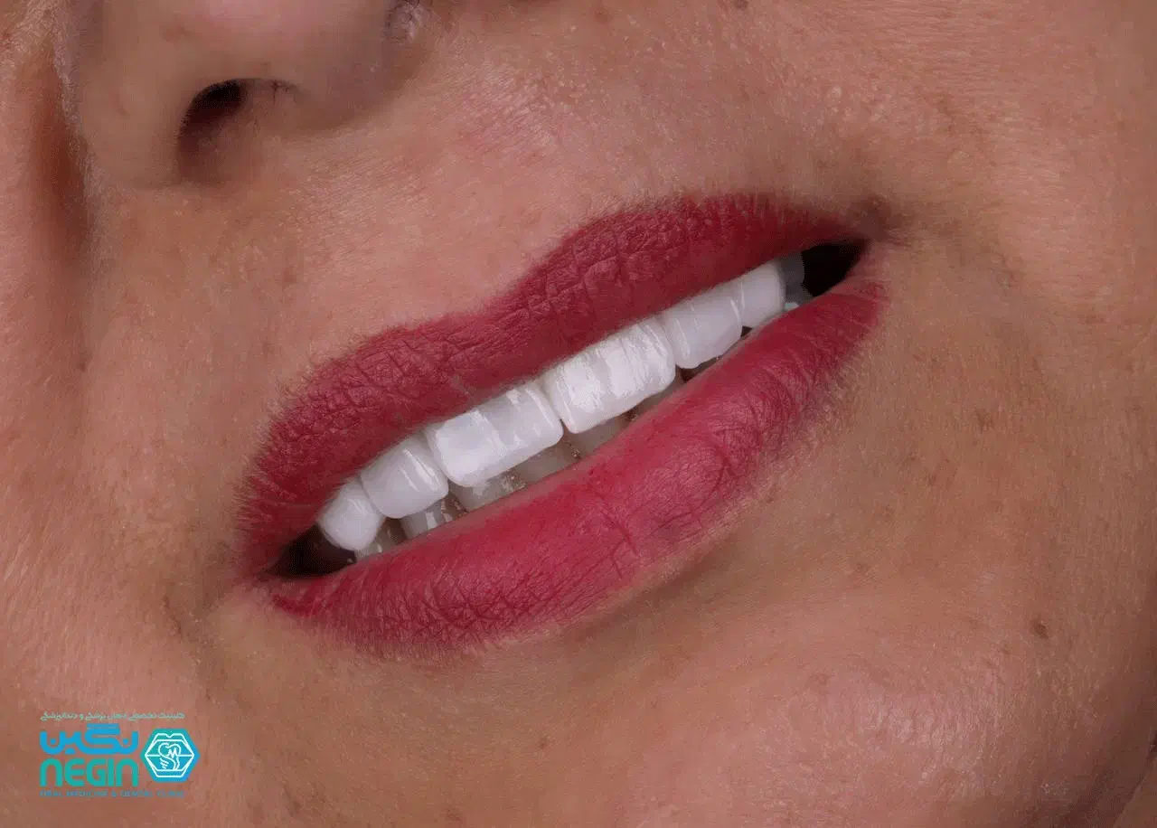 خدمات تخصصی دندانپزشکی در کلینیک نگین شیراز|خدمات آرایشگری و زیبایی|شیراز, زرگری|دیوار