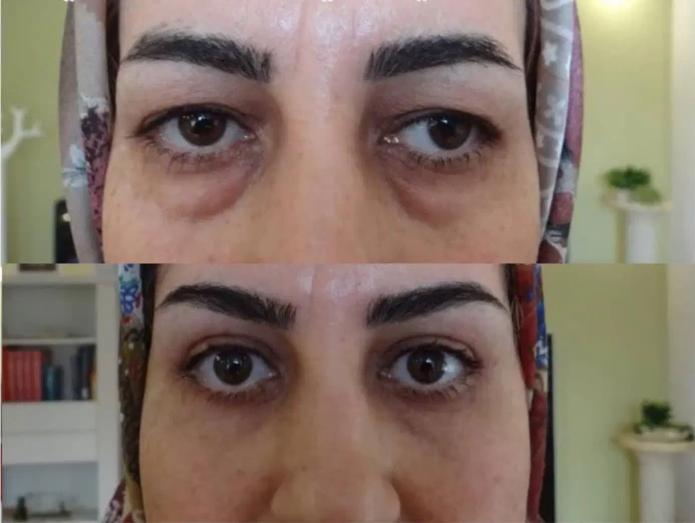 محصولات مراقبت پوستی|آرایشی، بهداشتی، درمانی|کامفیروز, |دیوار