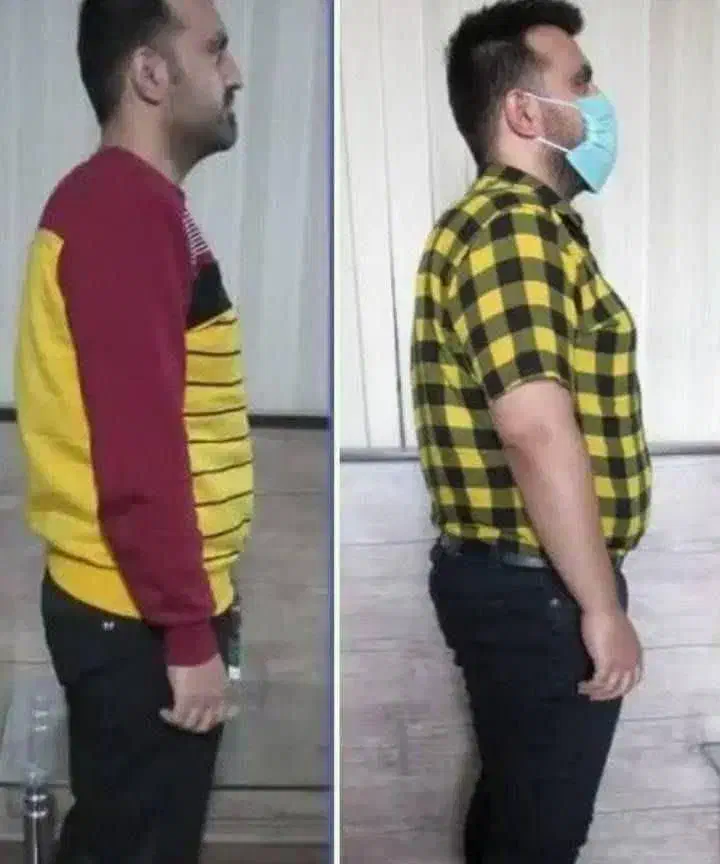 چربی سوزی شکم پهلو طبیعی|آرایشی، بهداشتی، درمانی|قائن, |دیوار