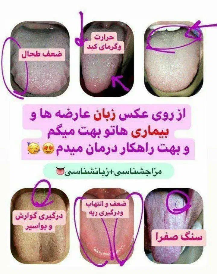 دعوت به کاردرمنزل ومشاوره رایگان مزاج شناسی|استخدام بازاریابی و فروش|دوگنبدان, |دیوار