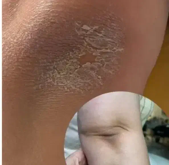 رفع تیرگی،آلگاپیل،لک صورت، پرسینگ، ژل صورت|خدمات آرایشگری و زیبایی|شیراز, سلطان آباد|دیوار