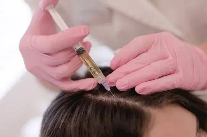 پی آر پی حجامت مزوژل بادکش امبدینگ طب سوزنی hpv|خدمات آرایشگری و زیبایی|اصفهان, جاوان|دیوار