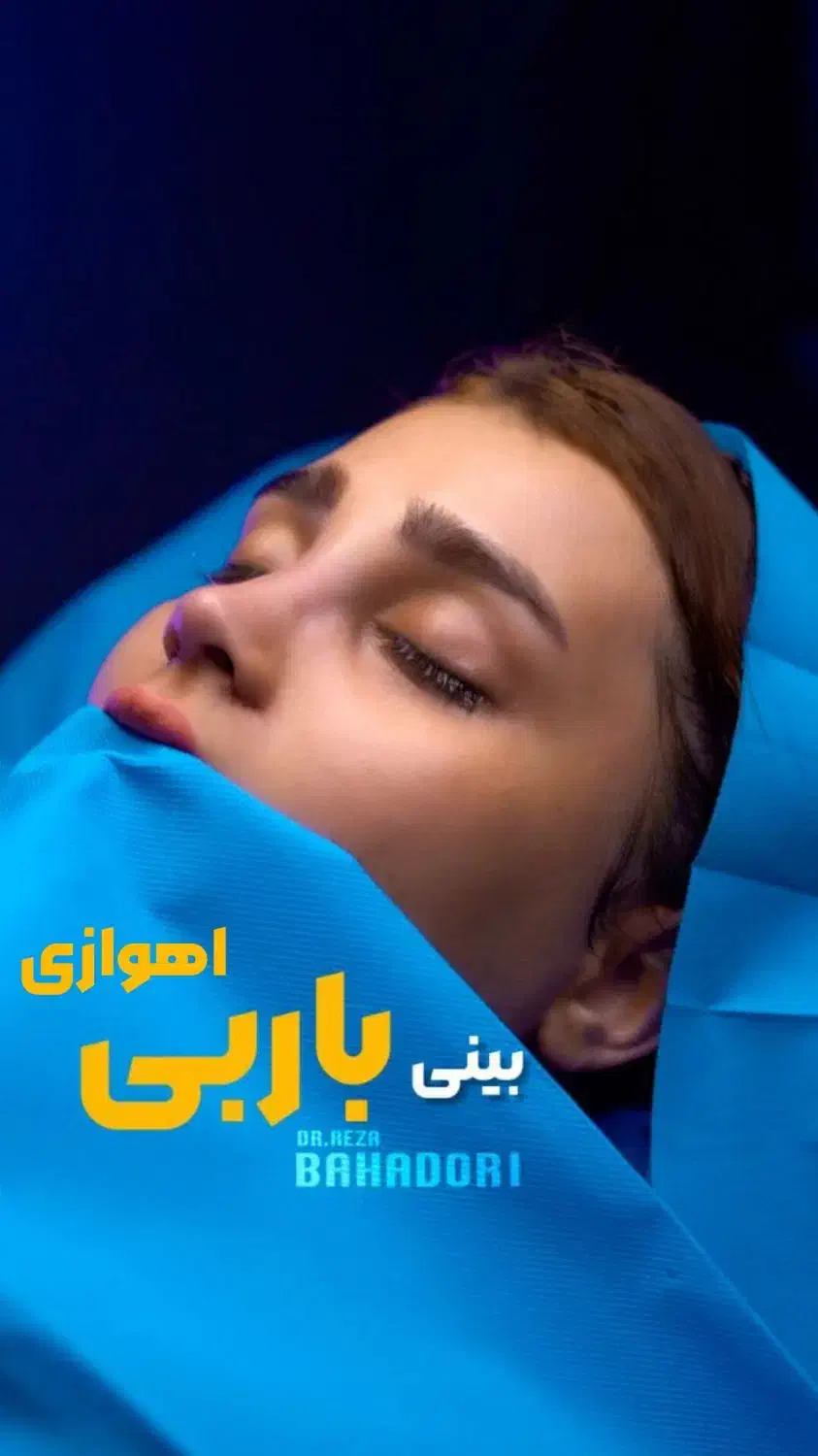 بینی باربی عمل بینی|پزشکی|اهواز, گلستان|دیوار