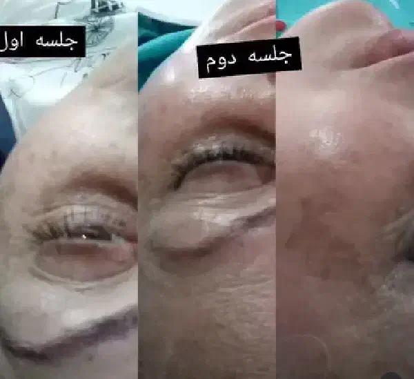 اسکین تراپیست|خدمات آرایشگری و زیبایی|شفت, |دیوار