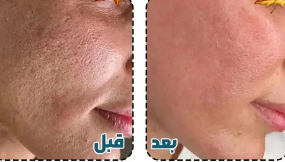 فشیال و تمامی خدمات پوستی|خدمات آرایشگری و زیبایی|خرم‌آباد, |دیوار