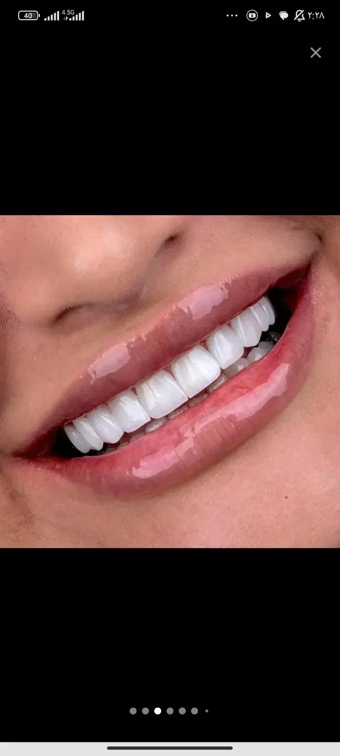 کامپوزیت|خدمات آرایشگری و زیبایی|اهواز, گلستان|دیوار