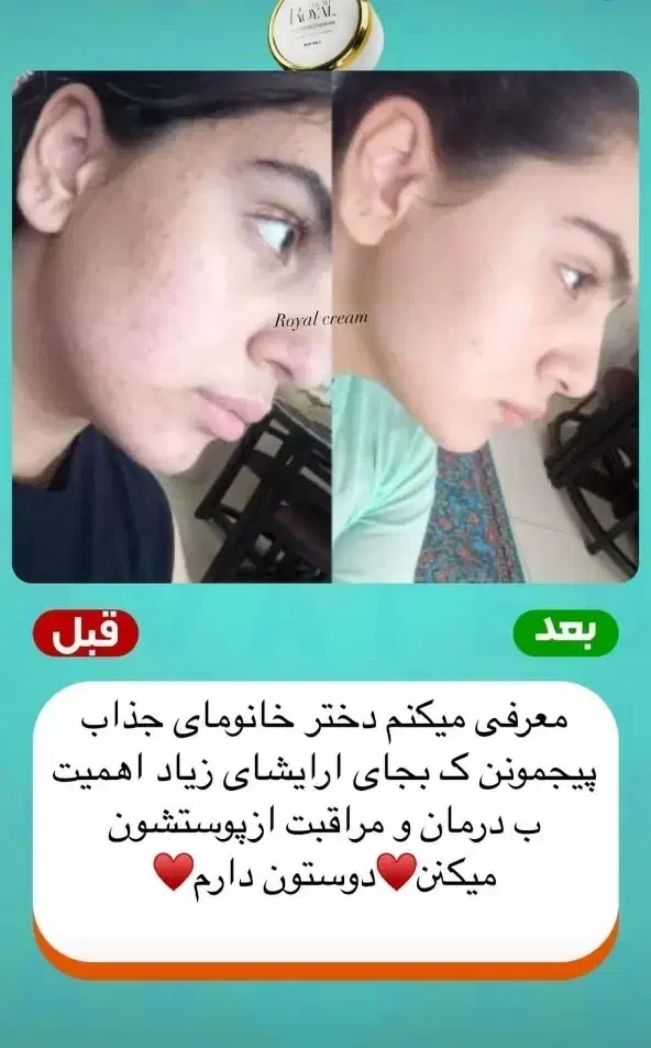 کرم رویال وصابون|آرایشی، بهداشتی، درمانی|لردگان, |دیوار