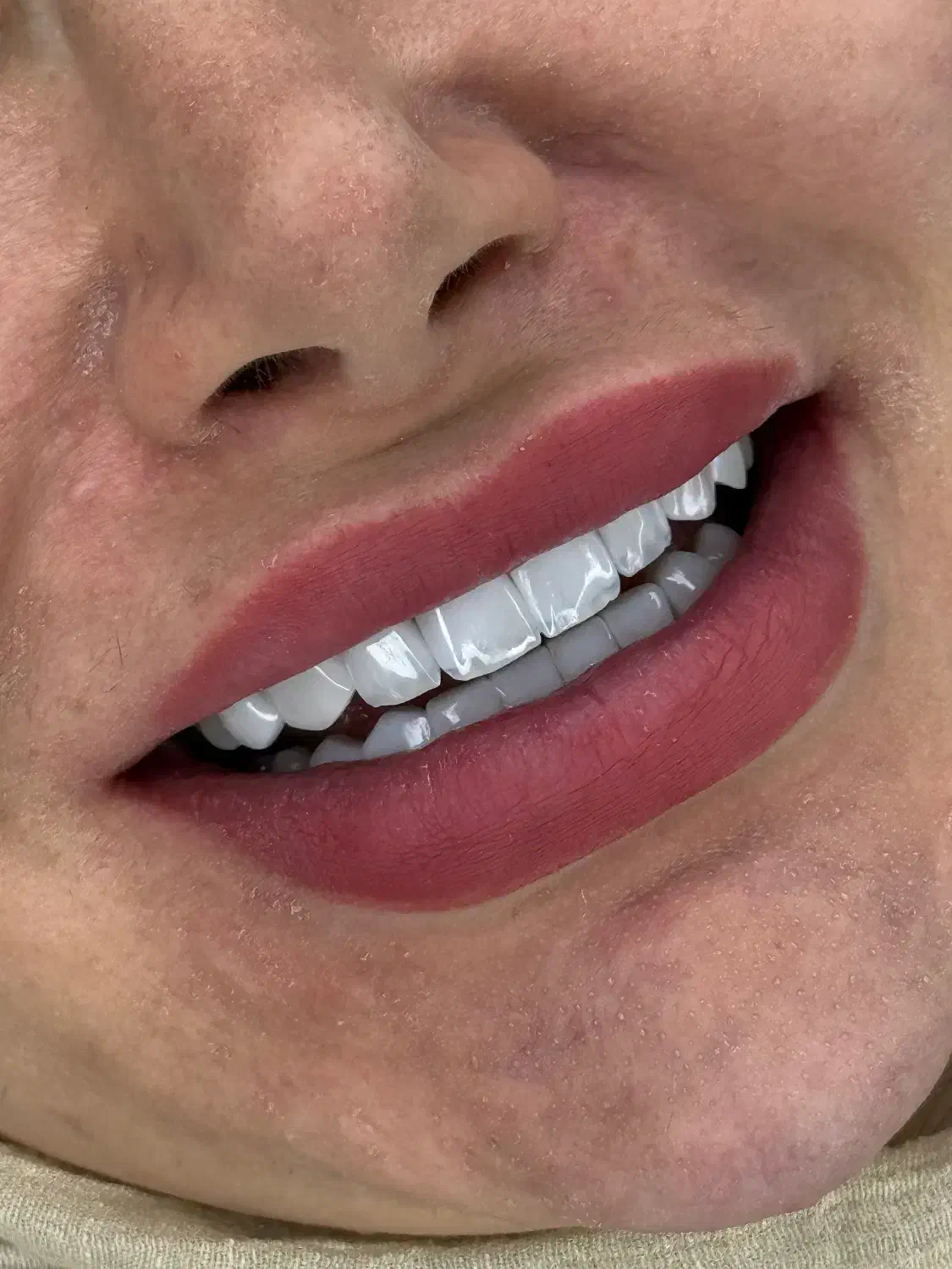 دستیار و پزیرش دندانپزشکی|استخدام درمانی، زیبایی، بهداشتی|تهران, نظامی گنجوی (توانیر)|دیوار