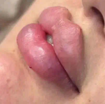 آف پنجاه درصد ژل و بوتاکس با بهترین برند|خدمات آرایشگری و زیبایی|اهواز, شریعتی جنوبی|دیوار