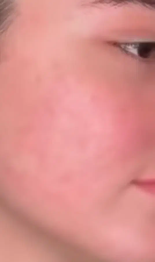 زیبایی پوست و مو|خدمات آرایشگری و زیبایی|سقز, |دیوار