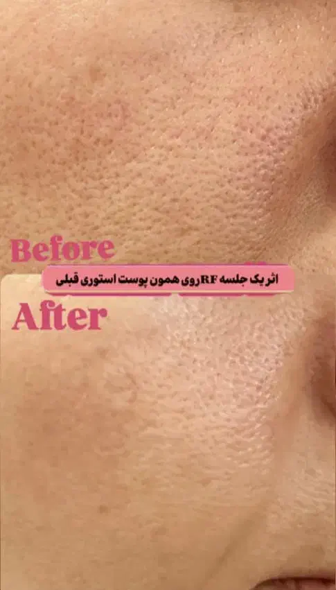 خدمات زیبایی پوست و مو در مطب دکتر شریفی|خدمات آرایشگری و زیبایی|فولادشهر, B5|دیوار