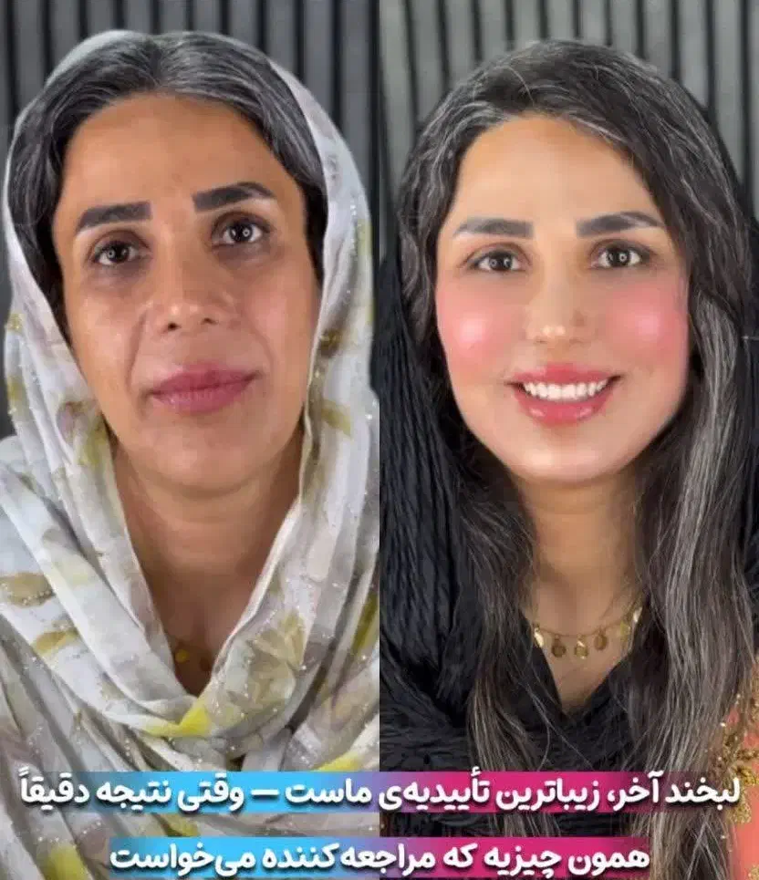 مرکز تخصصی جوانسازی اندولیفت/هایفو/لیفت فقط۸۹۰ت|خدمات آرایشگری و زیبایی|اصفهان, لاله|دیوار