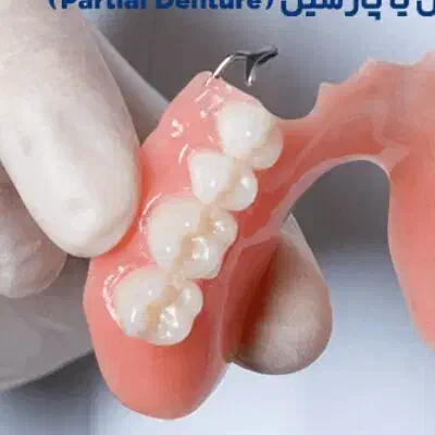 دندان گم شدهچند عدد دندان|آرایشی، بهداشتی، درمانی|سقز, |دیوار