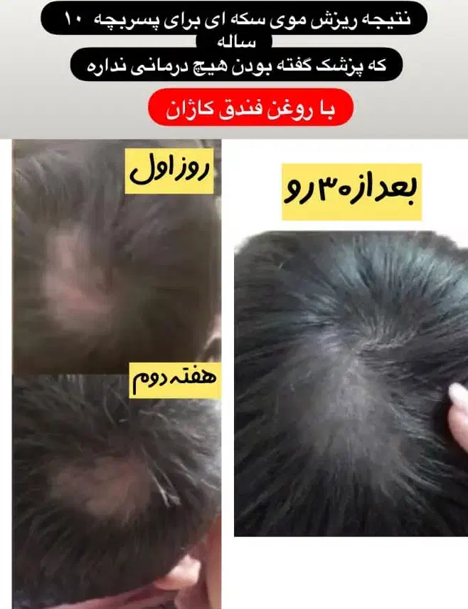 روغن های کاژان|آرایشی، بهداشتی، درمانی|بهبهان, |دیوار