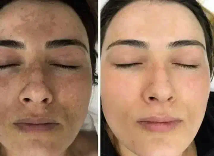 روغن خوراکی|خوردنی و آشامیدنی|برهسر, |دیوار