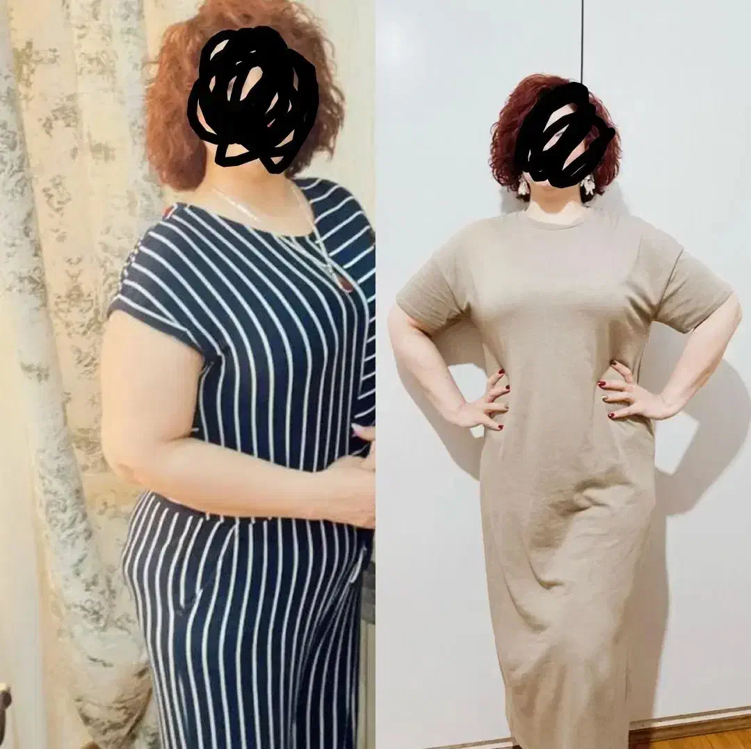 لاغری موضعی دستگاه|خدمات آرایشگری و زیبایی|کرج, اتحاد|دیوار