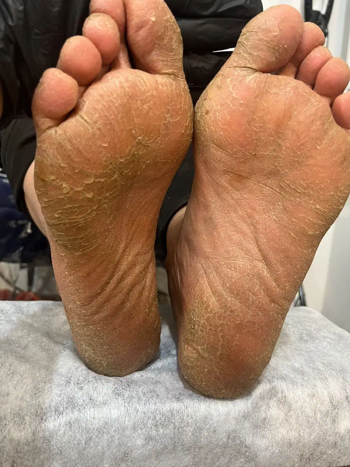 پدیکور فقط ۳۵۰|خدمات آرایشگری و زیبایی|ایذه, |دیوار