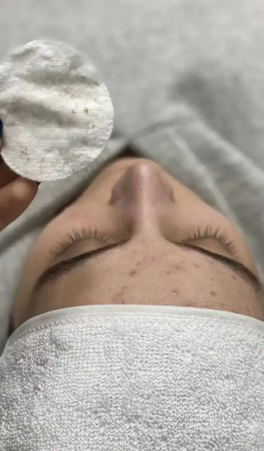 فیشیال و پاکسازی پوست بانوان|خدمات آرایشگری و زیبایی|کرمانشاه, |دیوار