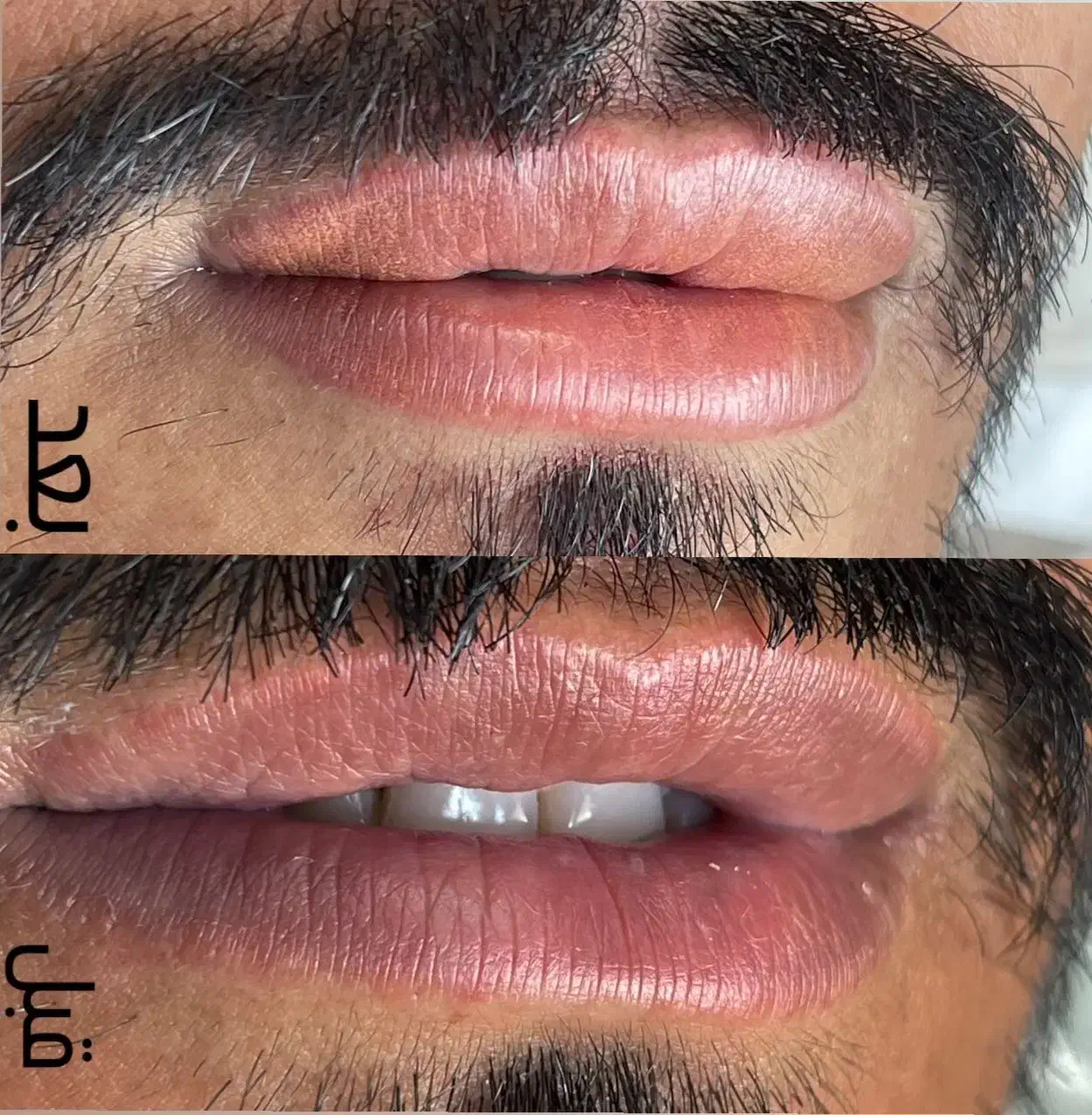 تنها راه درمان و رفع تیرگی لب آقایان|خدمات آرایشگری و زیبایی|مرودشت, بیست متری بیمارستان|دیوار