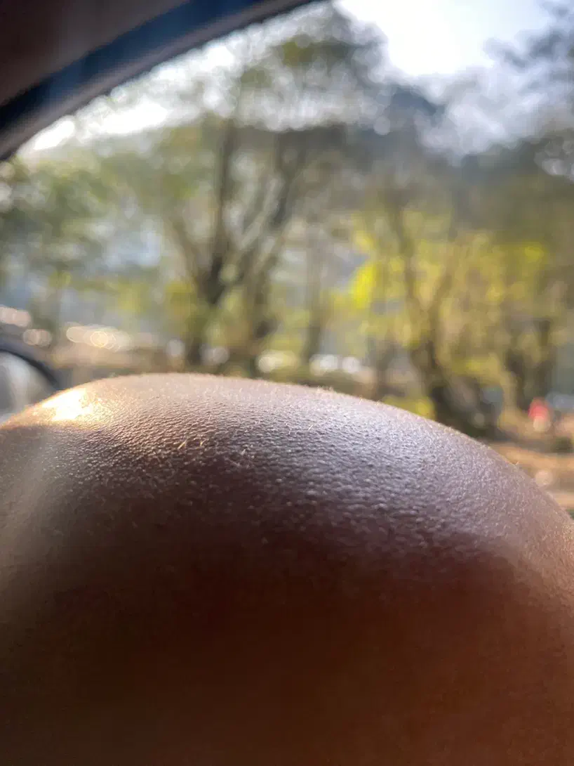 بیماران الوپسی|فعالیت داوطلبانه|رشت, معلم|دیوار