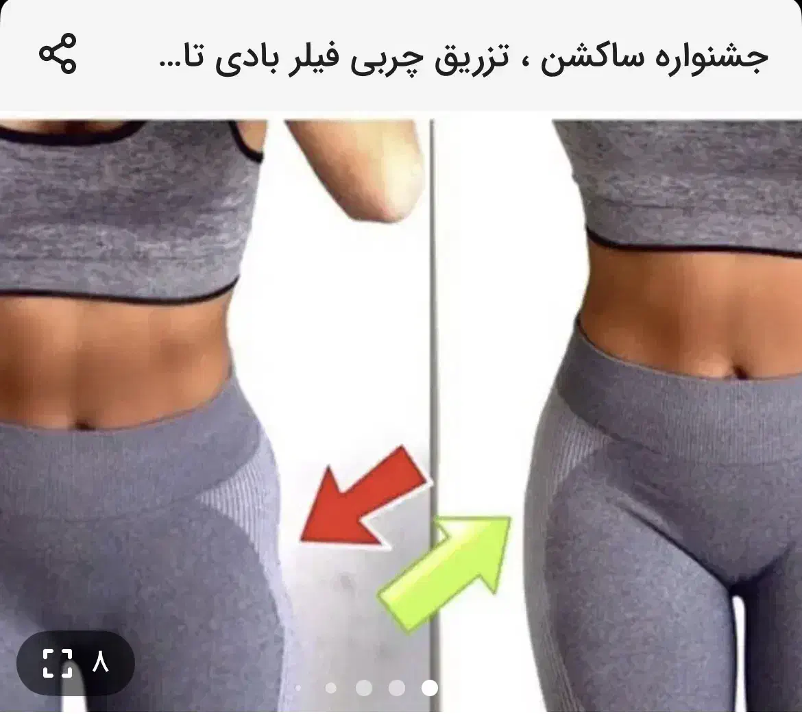 بلک فرایدی تخفیف استثنایی غبغب تزریق چربی فیلر|خدمات آرایشگری و زیبایی|تهران, دارآباد|دیوار