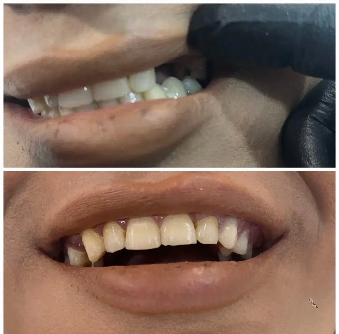 دندان سازی مروارید۳۰٪ اف|خدمات آرایشگری و زیبایی|بهبهان, |دیوار