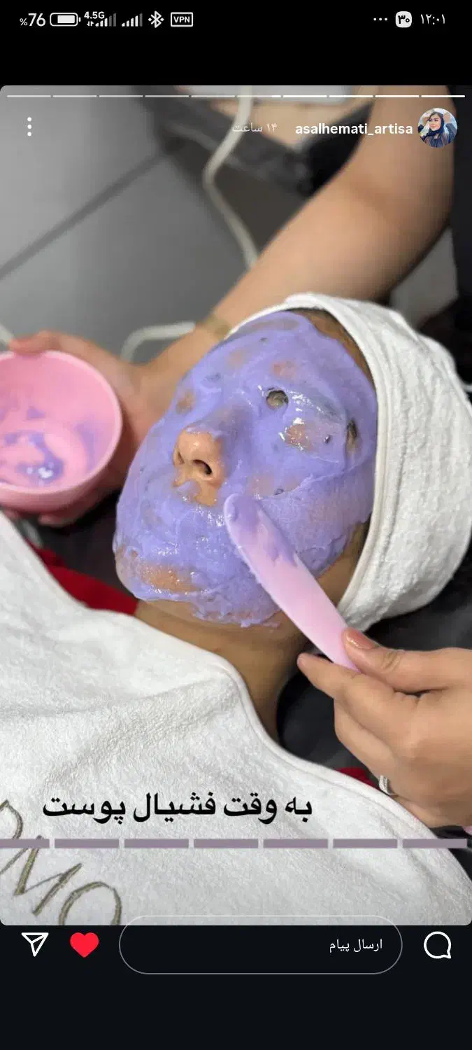 فیشال تخصصی.پاکسازی.کربوکسی.پلاژن تراپی.اسیدتراپی|خدمات آرایشگری و زیبایی|مشهد, انقلاب|دیوار