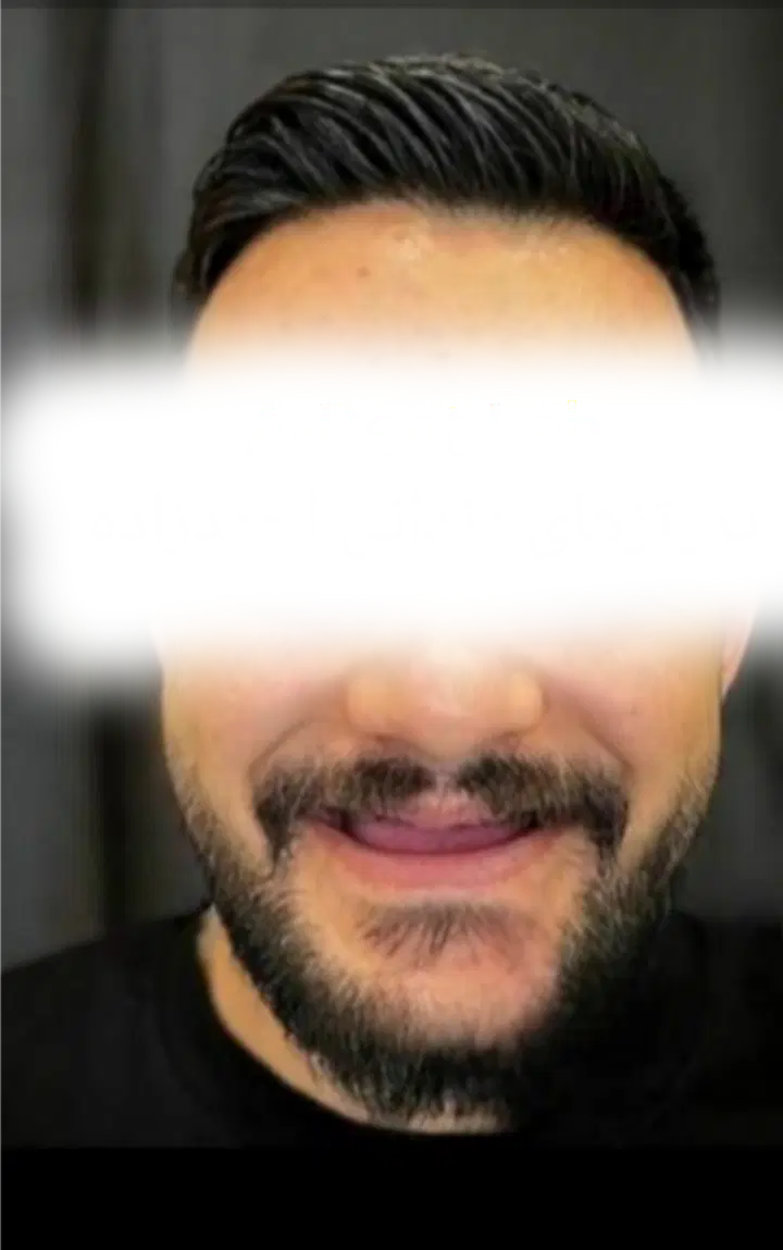 ساخت تخصصی دندان مصنوعی در استان قم|خدمات زیبایی و سلامت|قم, باغ شازده|دیوار