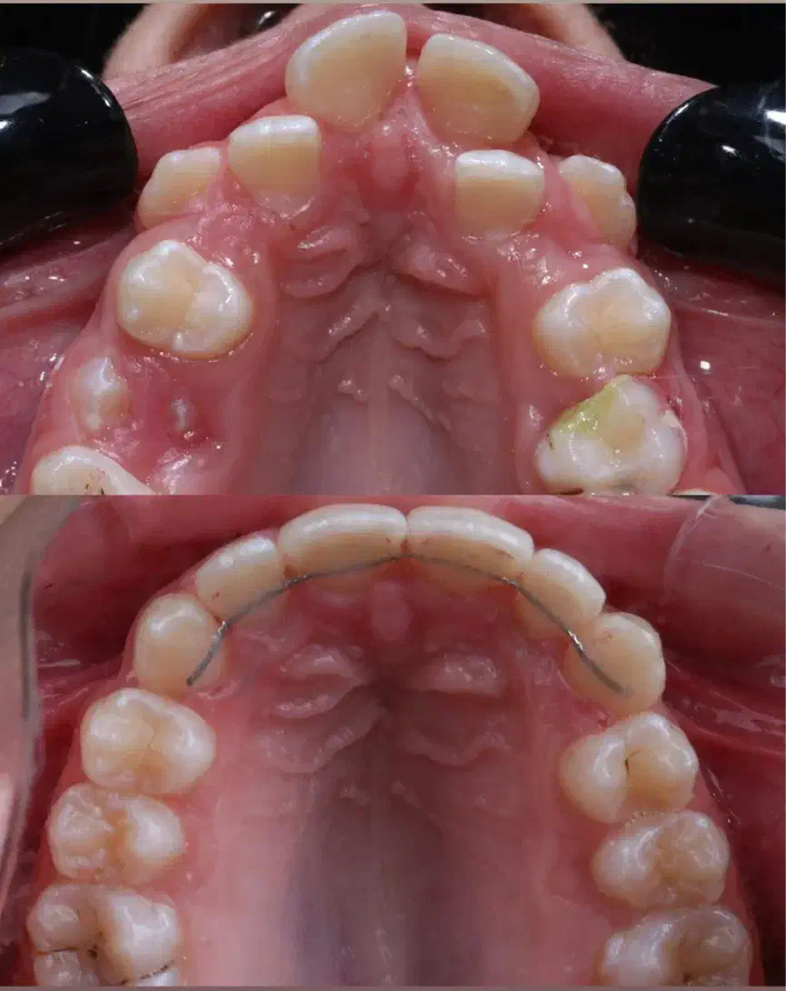 تخفیف و اقساط بلند مدت کلینیک دی|خدمات آرایشگری و زیبایی|آذرشهر, |دیوار