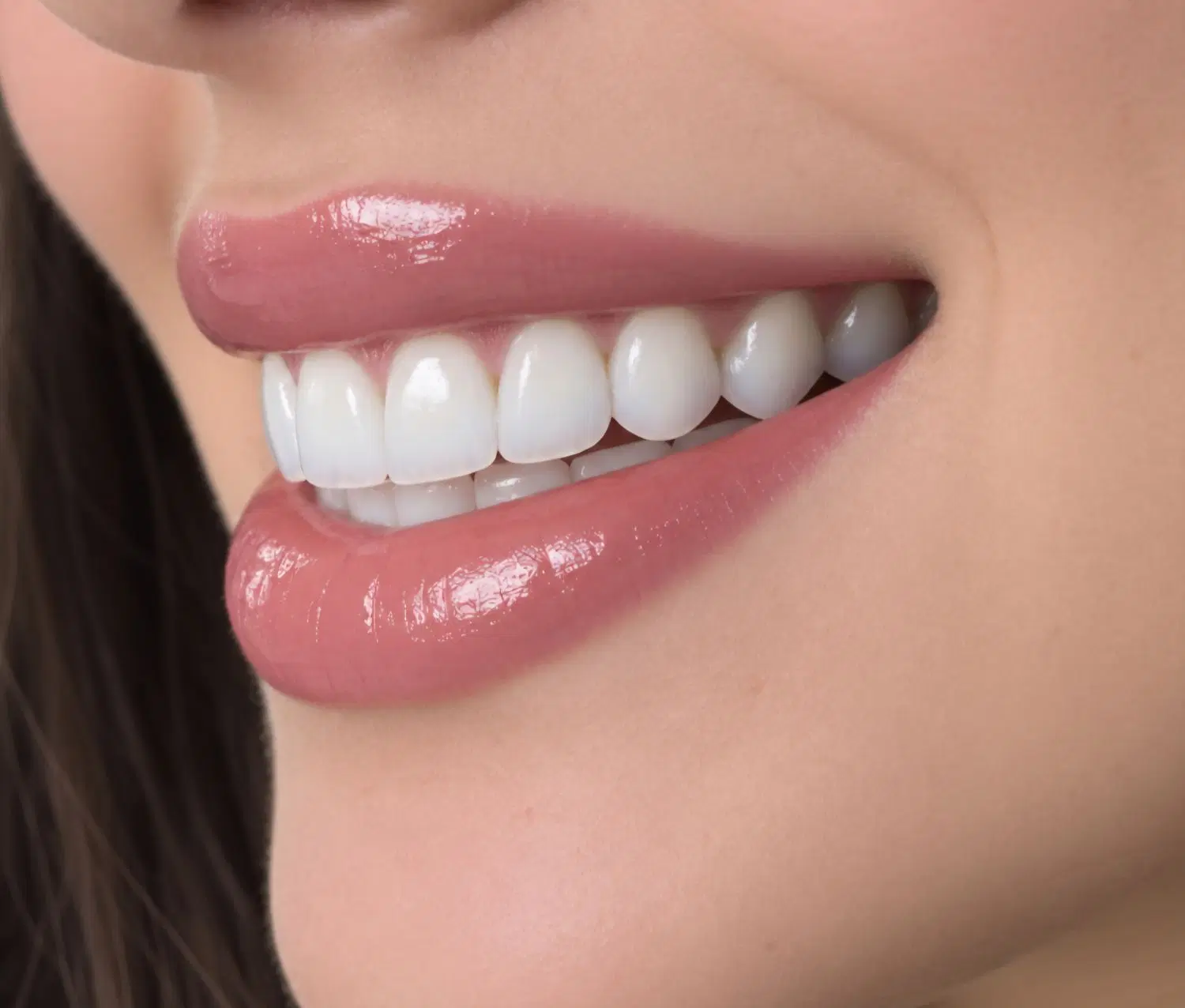 جشنواره خدمات دندانپزشکی با تخفیف های ویژه|خدمات زیبایی و سلامت|تهران, دزاشیب|دیوار
