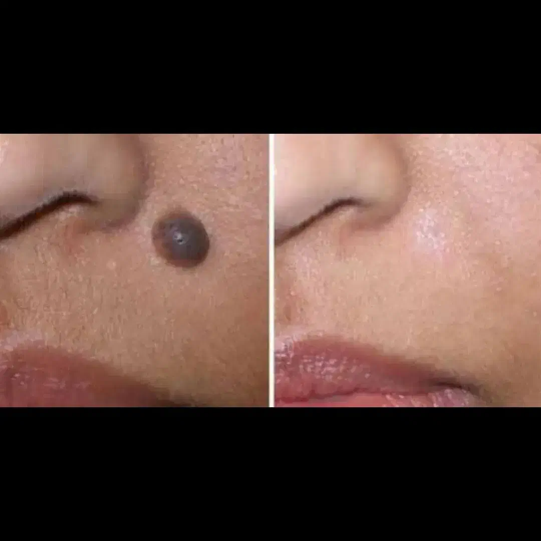 کلینیک تخصصی پوست ماهور (ستاره پوست(|خدمات آرایشگری و زیبایی|زابل, |دیوار