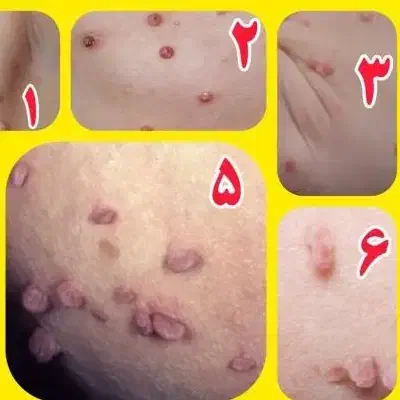 اچ پی وی|آرایشی، بهداشتی، درمانی|قم, شهر قائم|دیوار