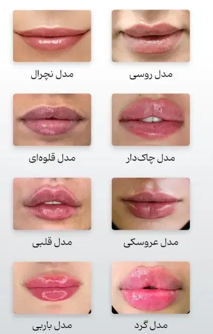 تزریق ژل و بوتاکس و لیزر موهای زائد|خدمات آرایشگری و زیبایی|شیراز, آزادگان|دیوار