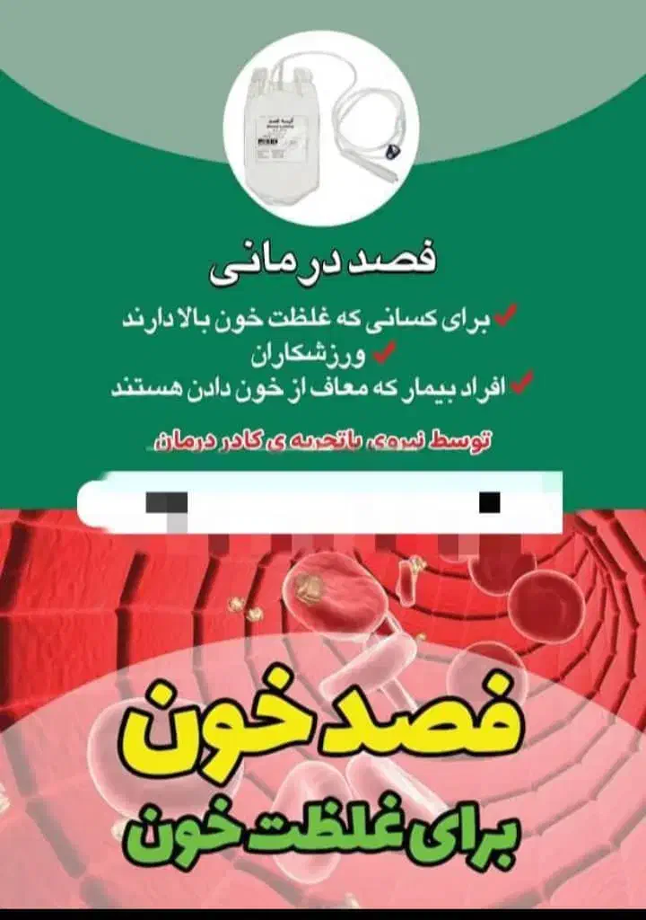 فصد در منزل|خدمات آرایشگری و زیبایی|علیآباد کتول, |دیوار