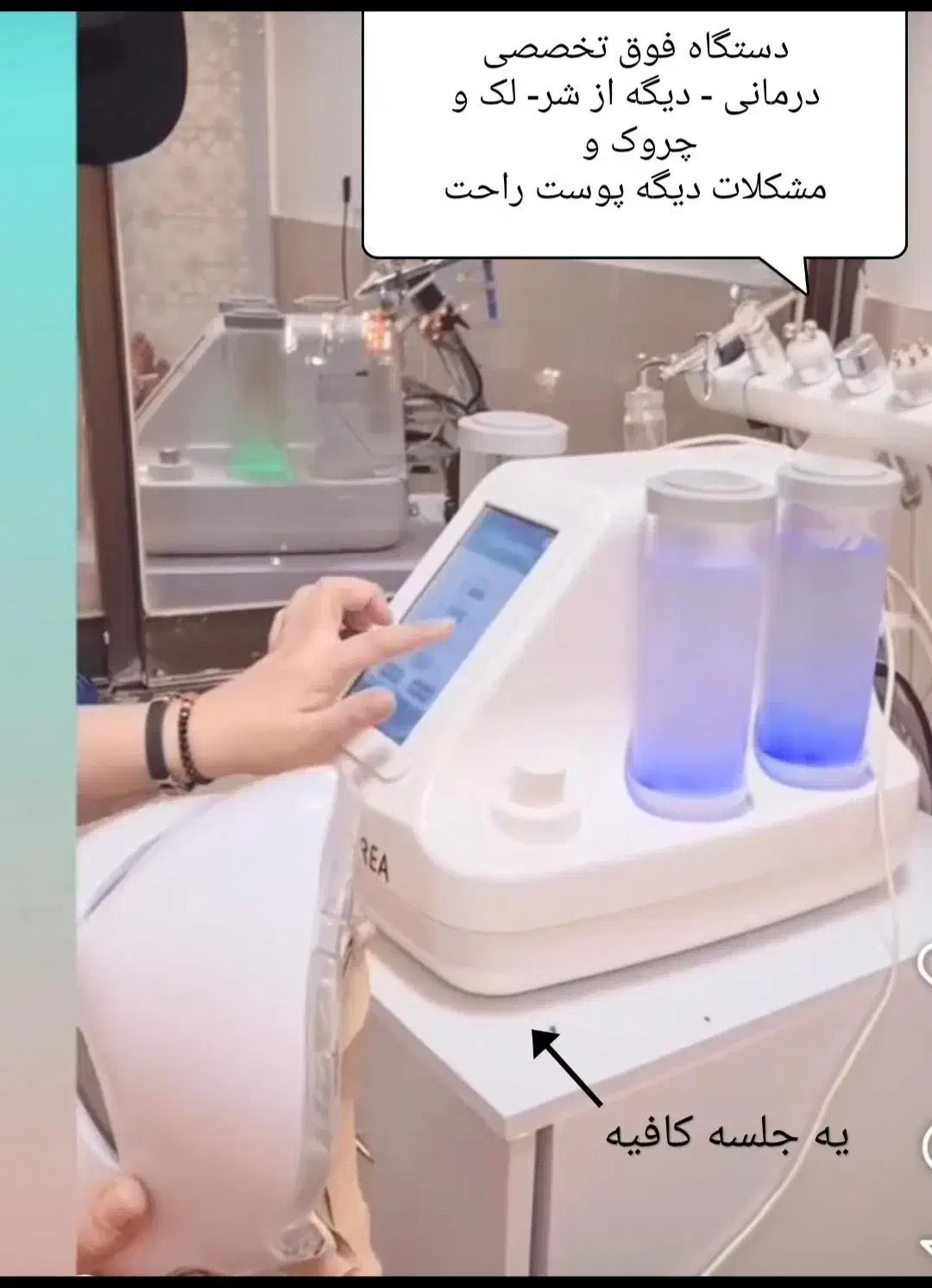 پاکسازی،فیشیال تخصصی،درمان مشکلات پوستی(تخفیف)|خدمات آرایشگری و زیبایی|گرگان, |دیوار