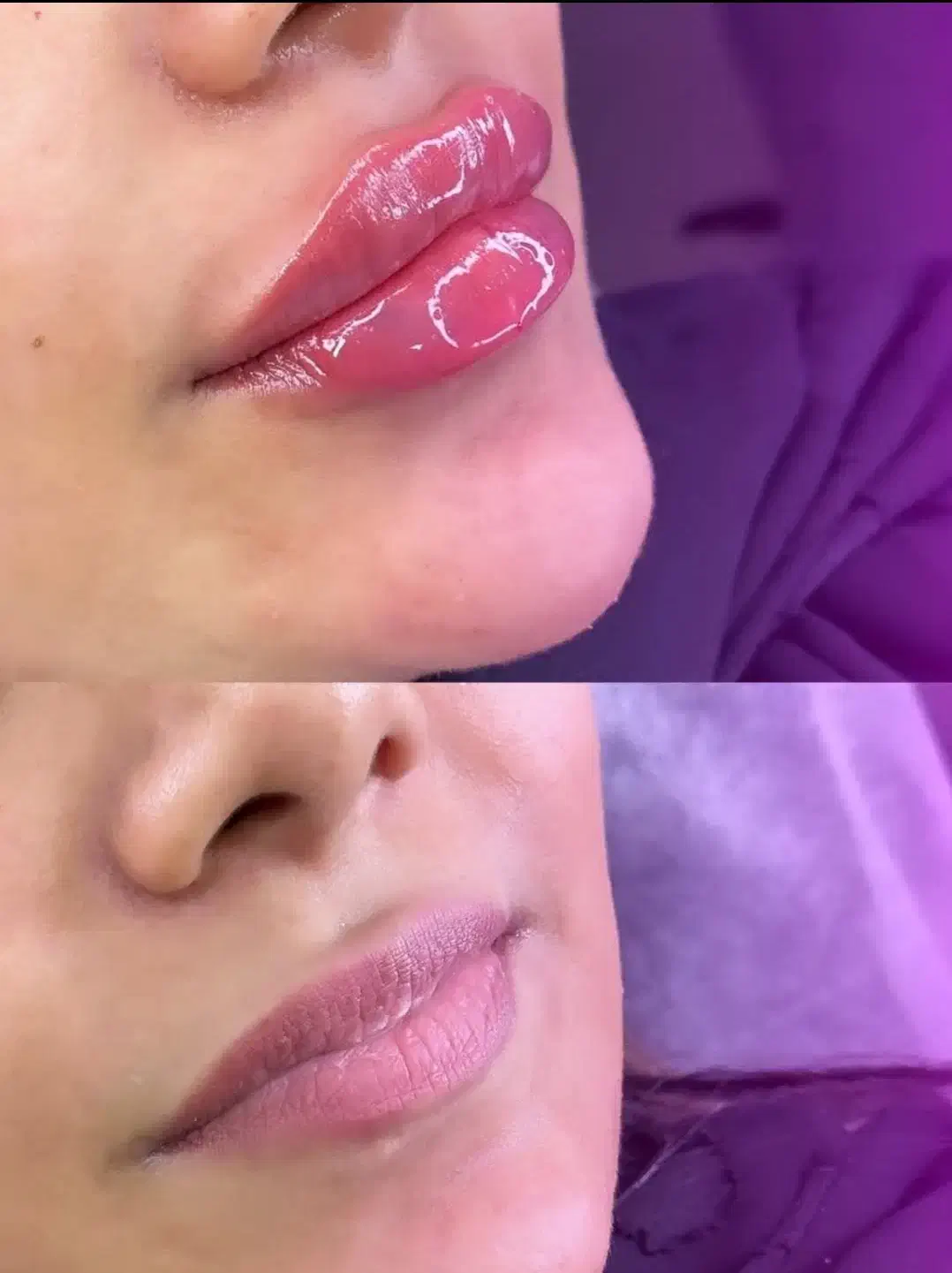 تزریق ژل و بوتاکس تخصصی|خدمات آرایشگری و زیبایی|اندیشه, اندیشه فاز ۱|دیوار