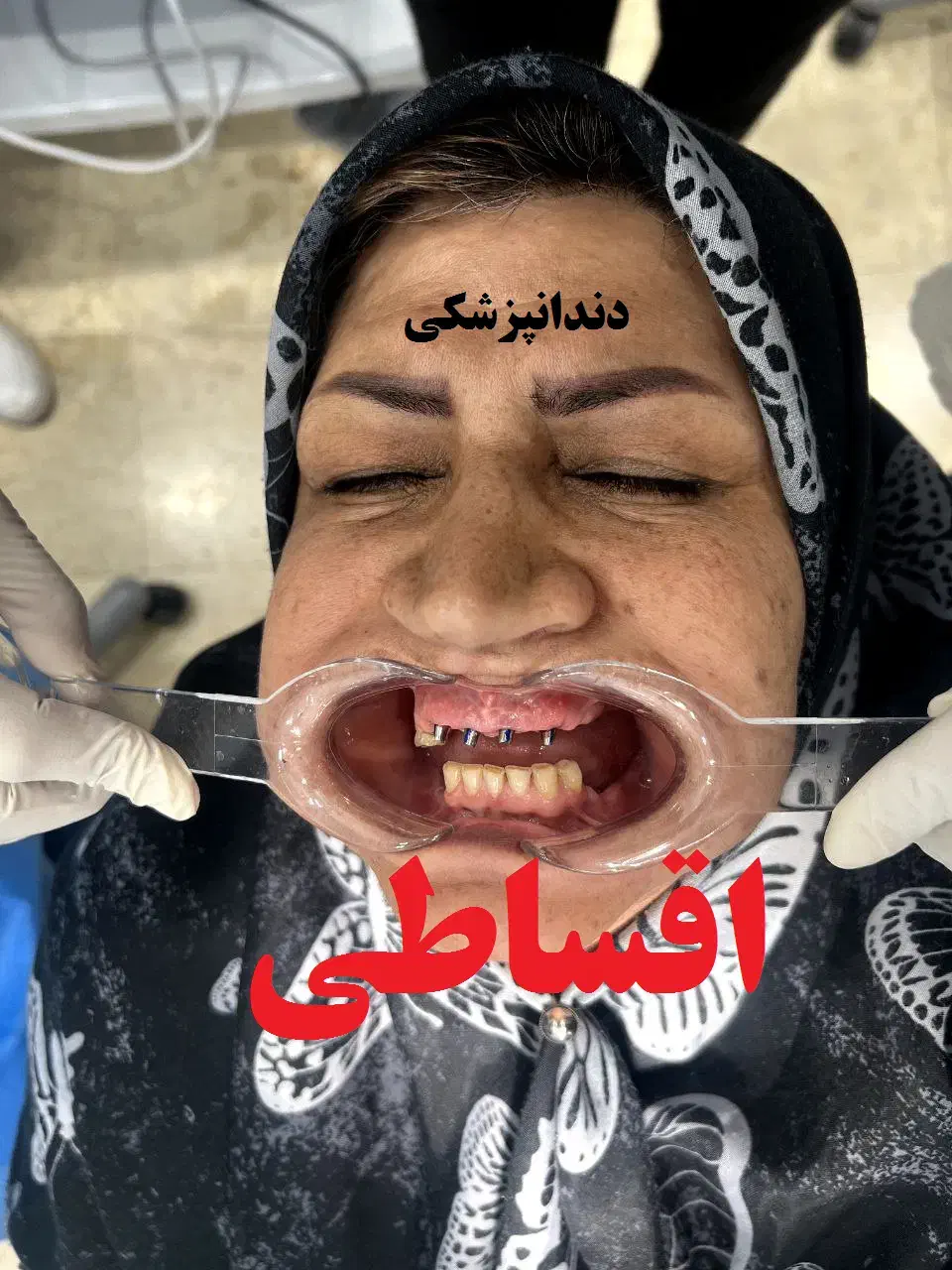 کلینیک دندانپزشکی قسطی بدون پیش پرداخت تمامی خدمات|خدمات آرایشگری و زیبایی|اصفهان, دشتستان|دیوار