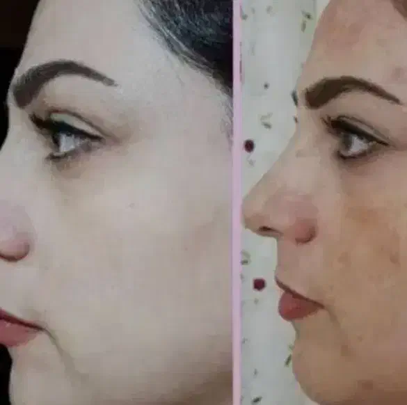 کرم عربی اصل|آرایشی، بهداشتی، درمانی|بندرعباس, |دیوار