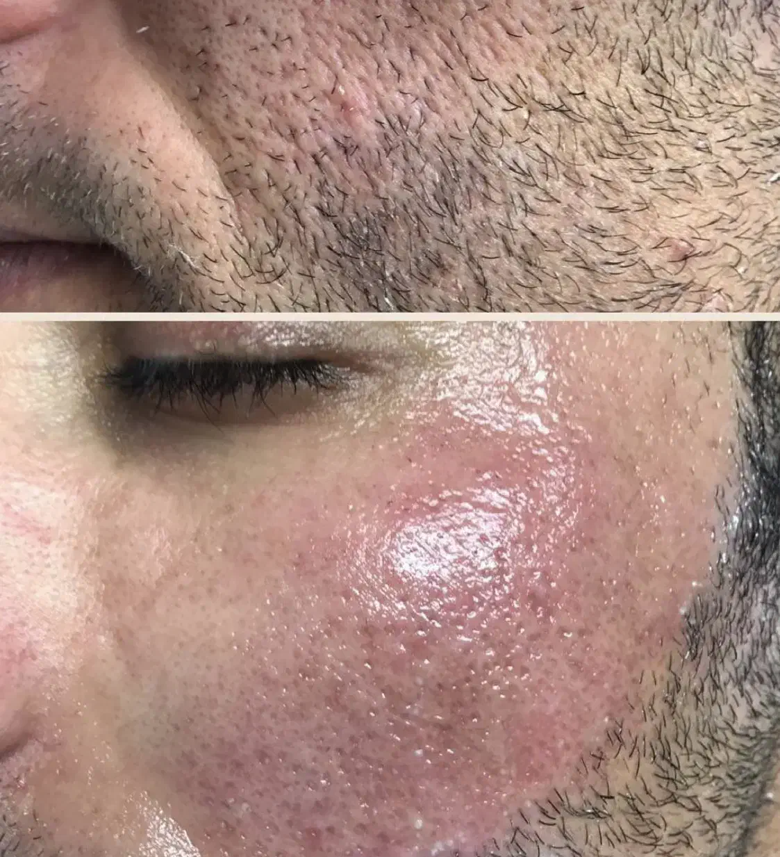 لیزر آقایان و بانوان|خدمات آرایشگری و زیبایی|تبریز, |دیوار