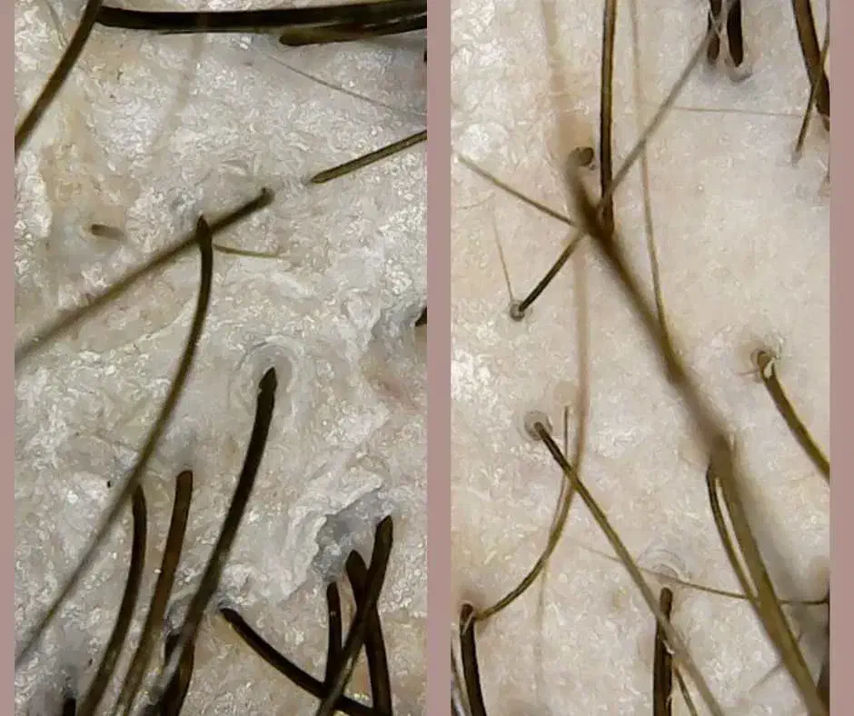 آموزش تخصصی اسکراب اسکالپ مو با ۵۰ درصد تخفیف|خدمات آموزشی|ارومیه, |دیوار