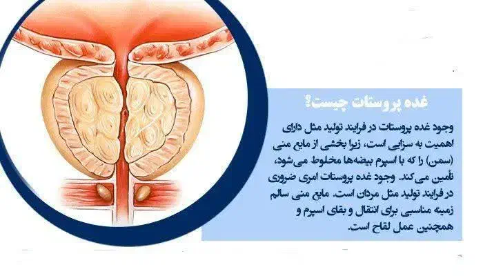 درمان تضمینی پروستات و مشکلات ادرار|خدمات آرایشگری و زیبایی|بانه, |دیوار