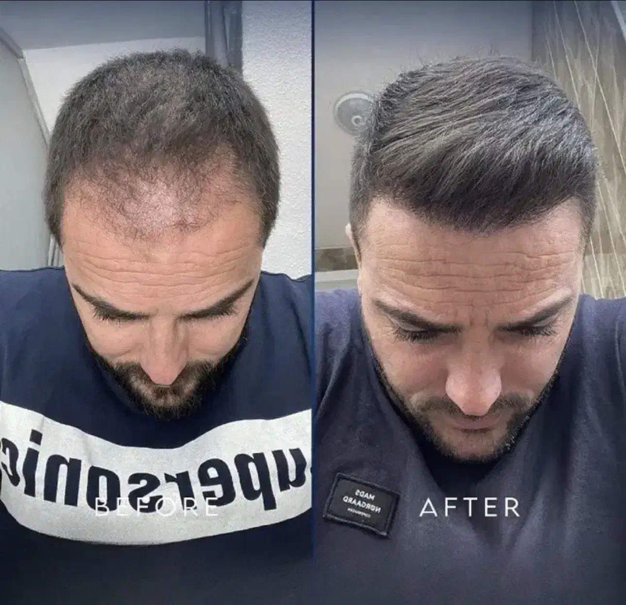 مشاوره کاشت مو،ابرو و کلیه خدمات زیبایی رایگان|خدمات آرایشگری و زیبایی|مشهد, فرهنگ|دیوار