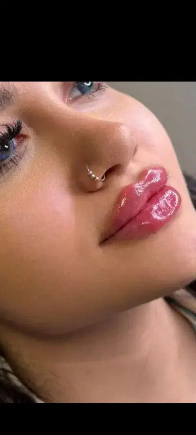 تزریق ژل لب روسی/بوتاکس|خدمات آرایشگری و زیبایی|اردبیل, |دیوار